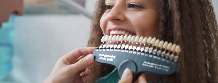 teeth whitening