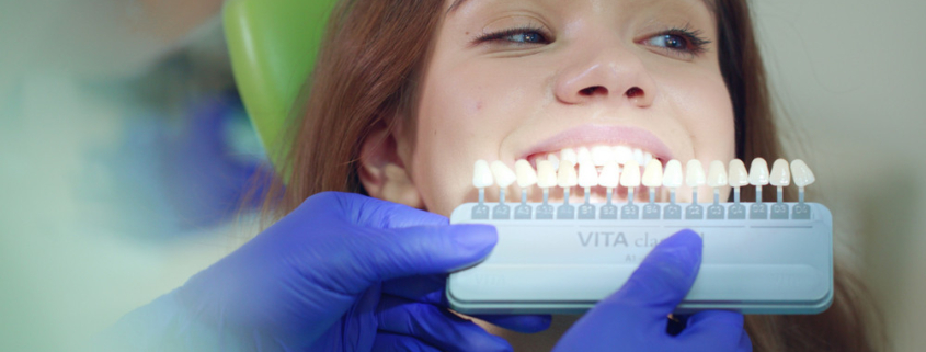 teeth whitening