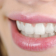 invisalign